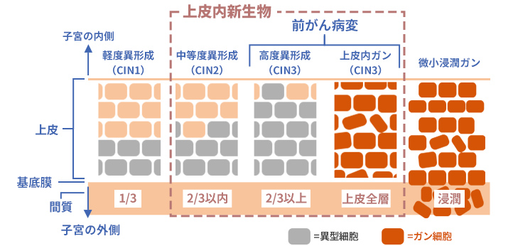 図表5 年齢階級別ガン羅患率