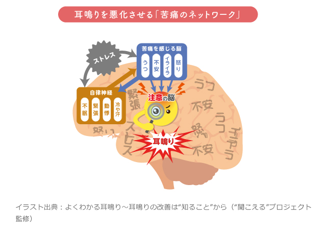 イメージ：イラスト出典：よくわかる耳鳴り～耳鳴りの改善は“知ること”から（“聞こえる”プロジェクト監修）