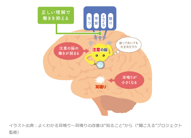 イメージ：イラスト出典：よくわかる耳鳴り～耳鳴りの改善は“知ること”から（“聞こえる”プロジェクト監修）