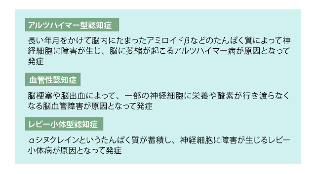 アルツハイマー型認知症／血管性認知症／レビー小体型認知症