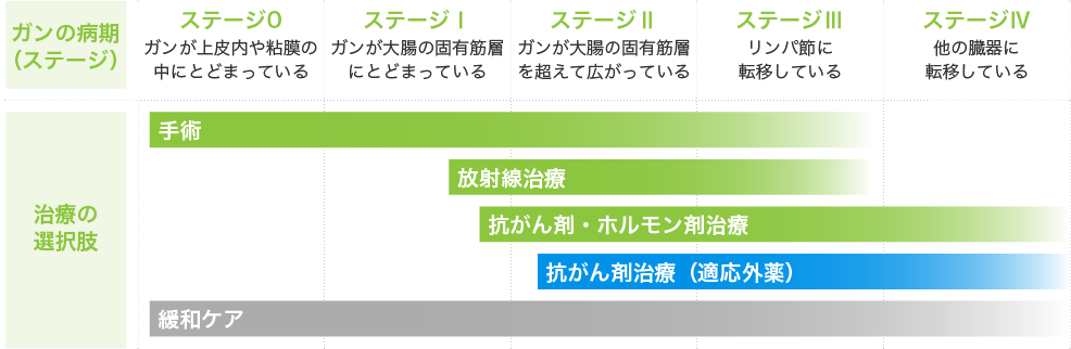 ガンの病期（ステージ）別の治療法（大腸ガンの場合）イメージ図