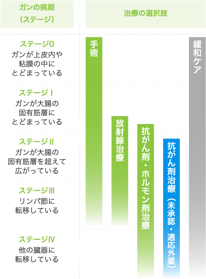 ガンの病期（ステージ）別の治療法（大腸ガンの場合）イメージ図